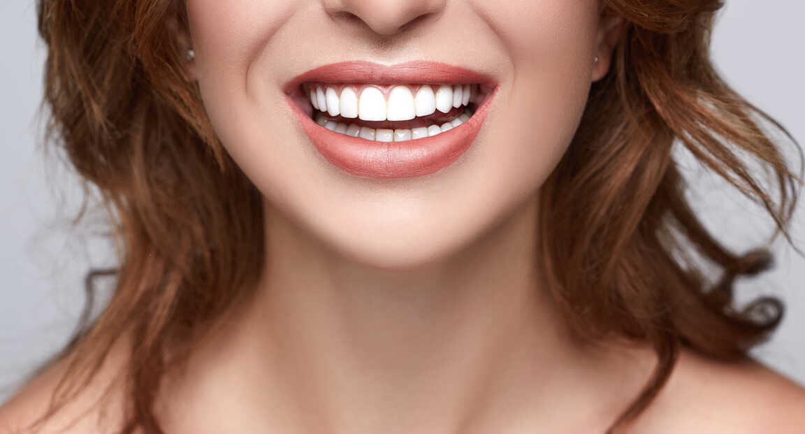 A tökéletes hollywoodi mosoly titka: a porcelán héj